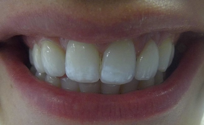 After