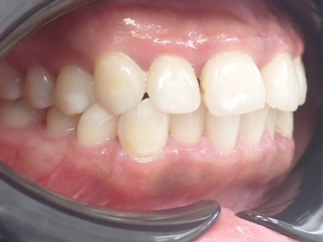 Before